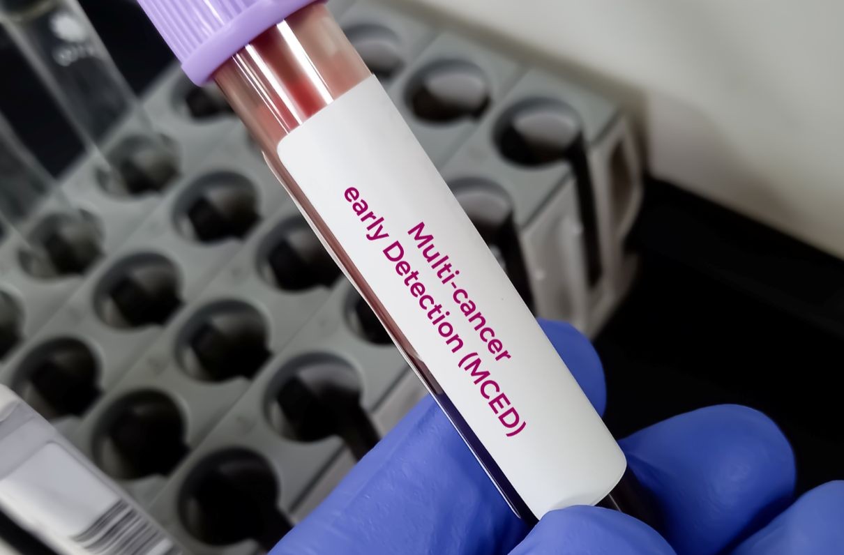 cancer-test-vial-h.jpg