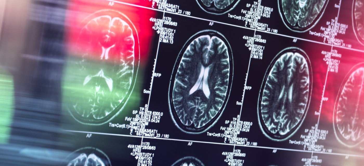 brain-scan-stock-c.jpg