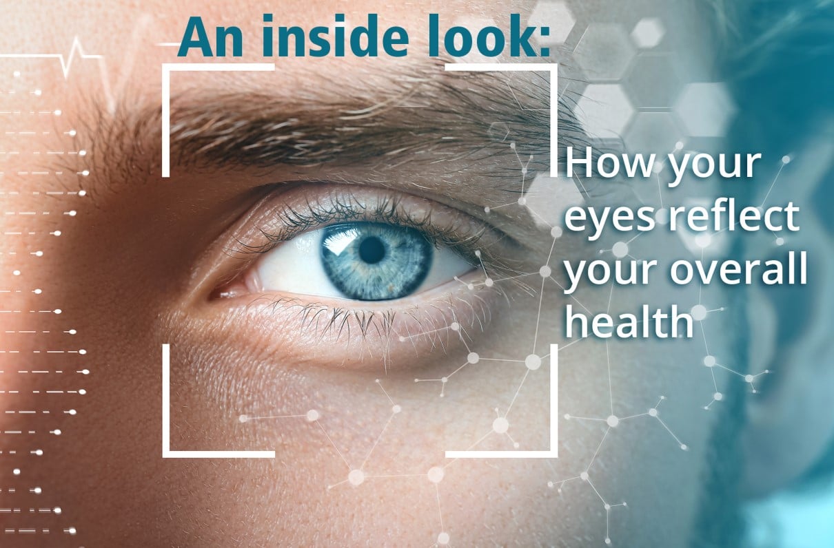 An Inside Look: How Your Eyes Reflect Your Overall Health