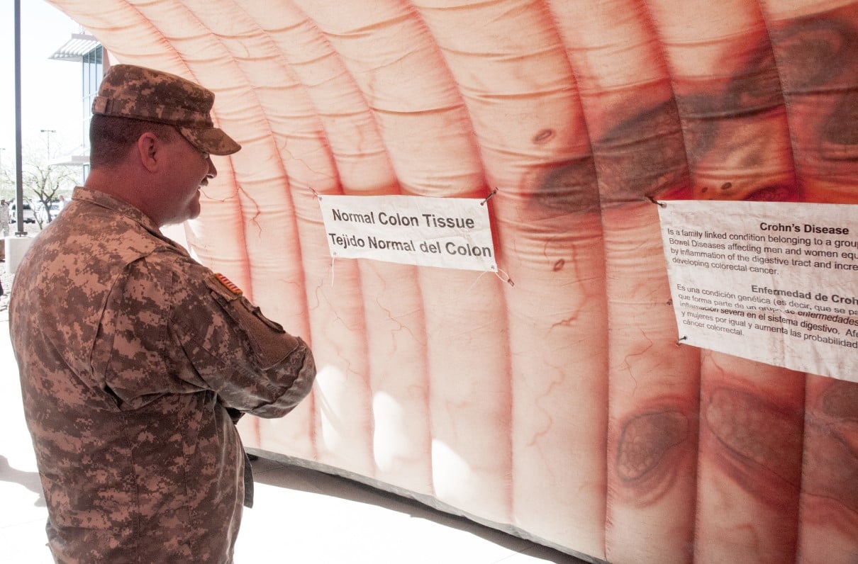 TRICARE Lowers Age for Colon Cancer Screenings to 45